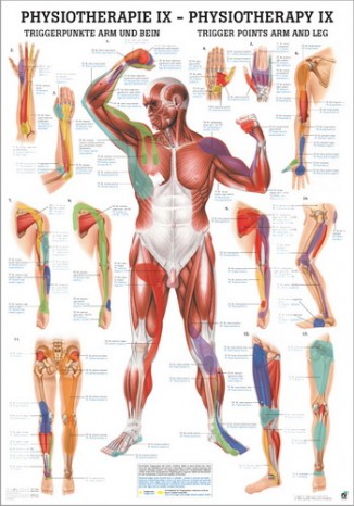 Trigger points arm and leg (poster 24cm x 34cm) 