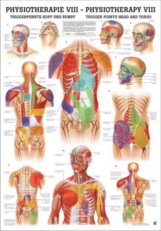Trigger Points Head and Trunk (Poster 24cm x 34cm) 